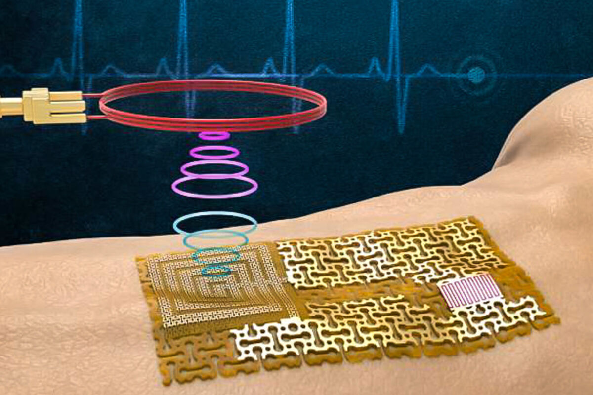 A rendering of MIT's gallium-gold bandage sensor on an arm.
