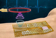 A rendering of MIT's gallium-gold bandage sensor on an arm.